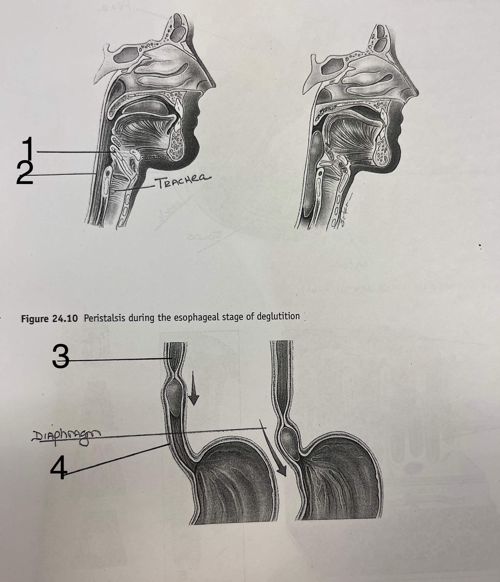 <p>What is #1</p>