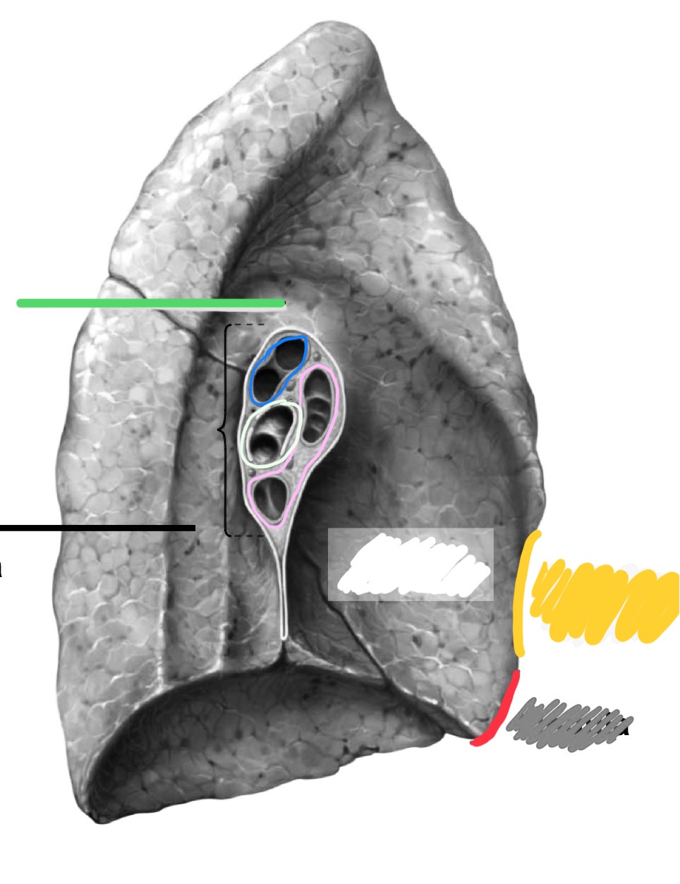 <p>What groove is identified by the green?</p>