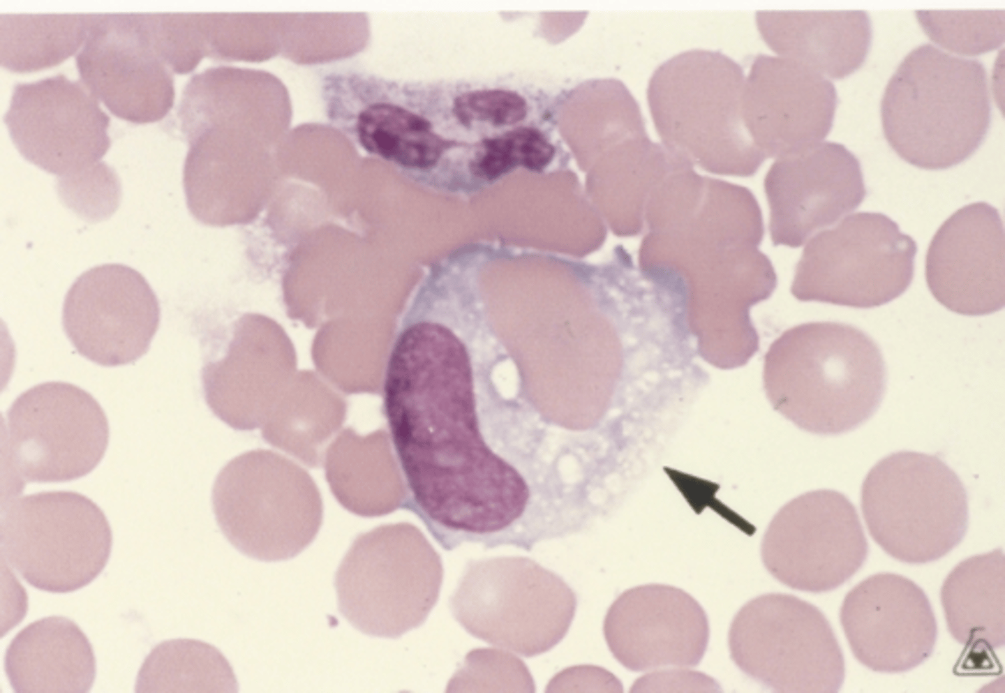 <p>Identify the cells in this body fluid</p>