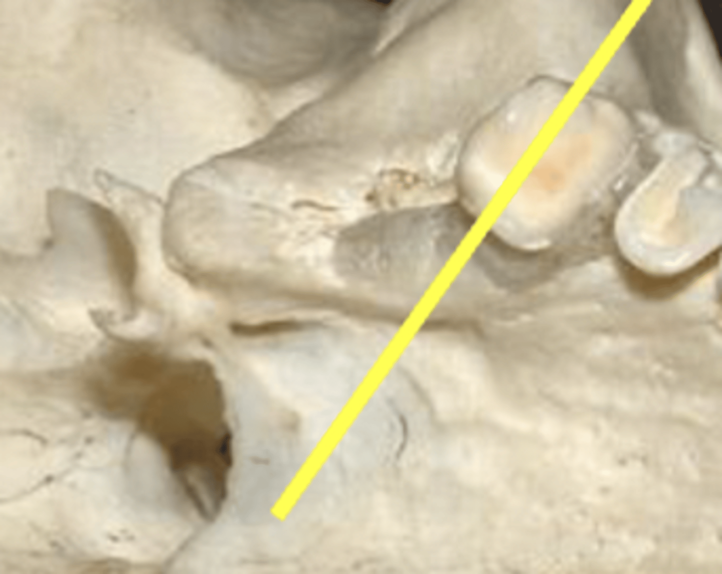 <p>palatine bone</p>