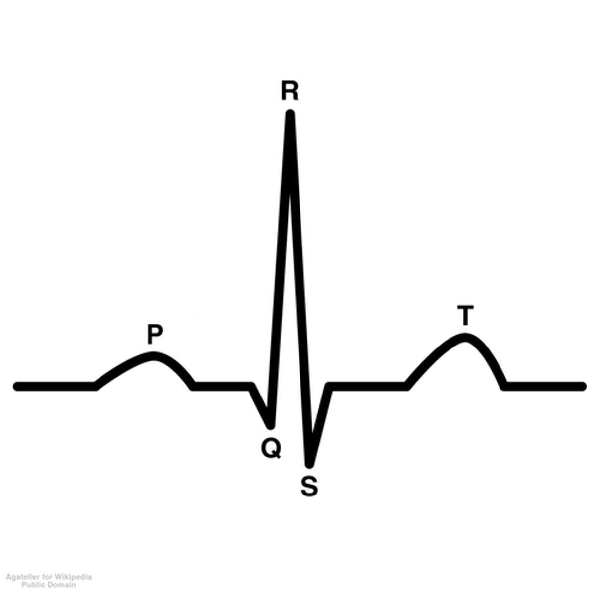 <p>within an ECG, what interval represents beginning of atrial excitation to beginning to ventricular excitation?</p>