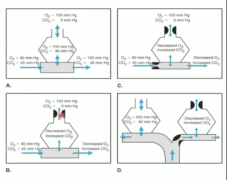 <ul><li><p><span>Normal: matched ventilation/perfusion</span></p></li><li><p><span>Hypoventilation: low O₂, high CO₂</span></p></li><li><p><span>HPV: constricts vessels near hypoxic alveoli → diverts blood to better ventilated regions</span></p></li><li><p><span>Maintains efficient gas exchange</span></p></li></ul><p></p>