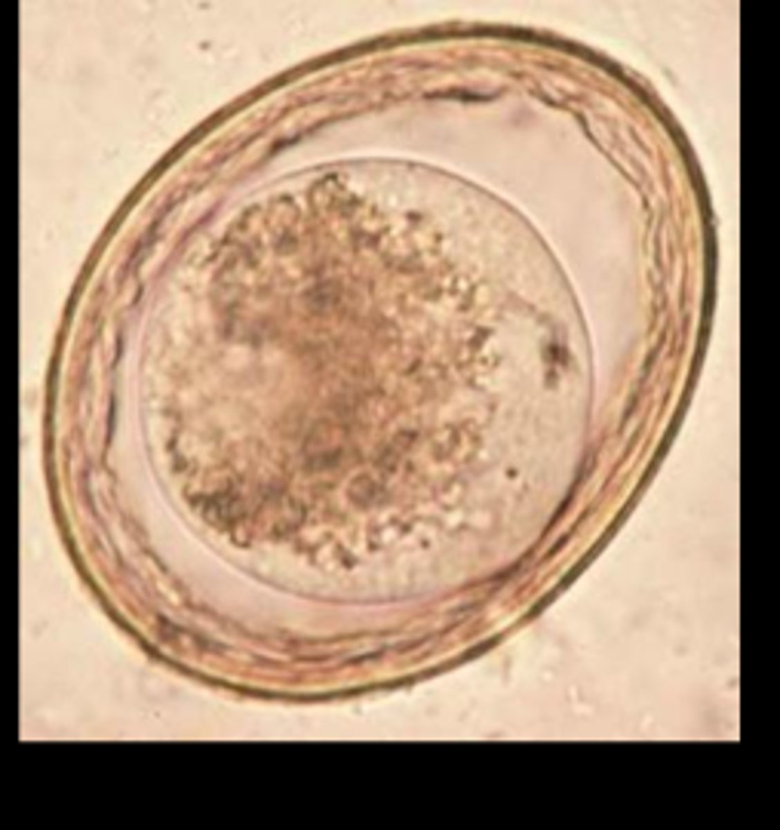 <p>egg</p>