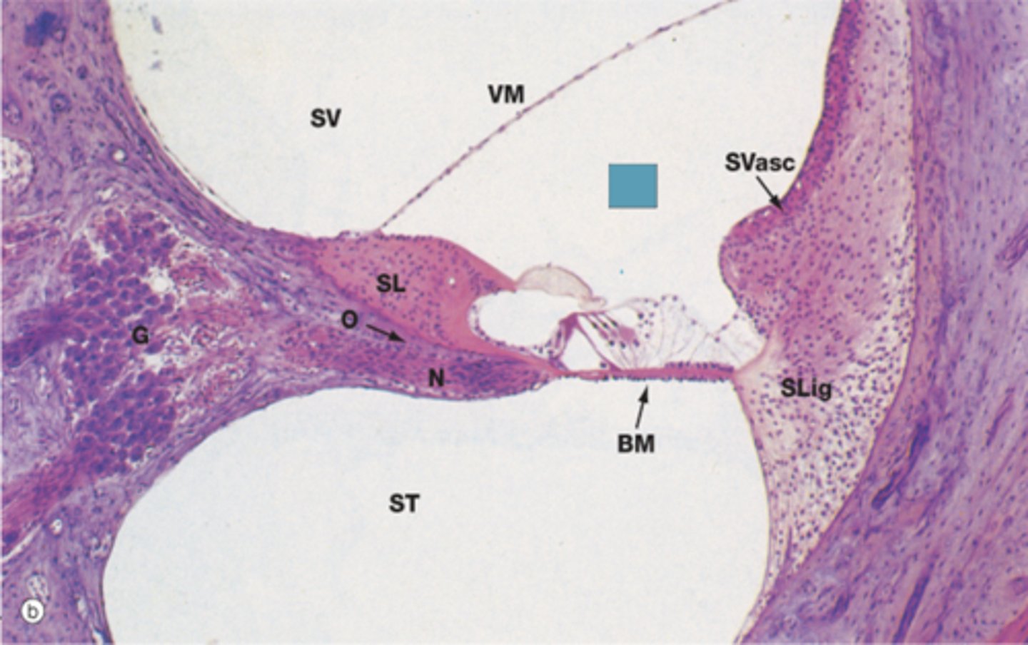 <p>Identify the structure (BLUE BOX)</p>