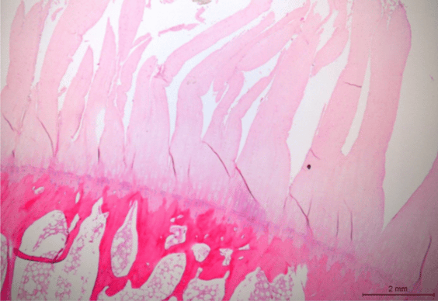 <p>Identify the pathology:</p>