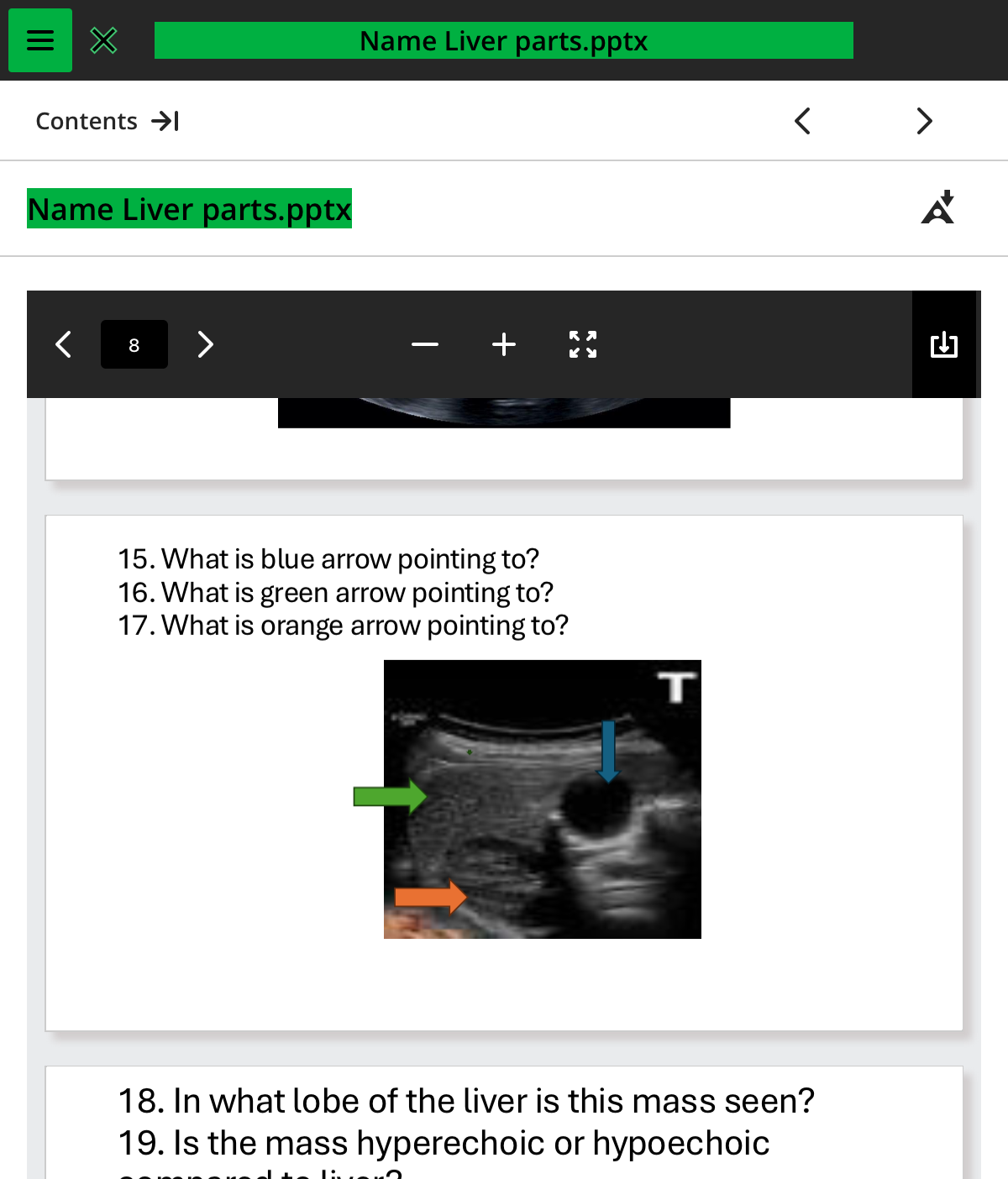 <ol start="16"><li><p>what is the green arrow pointing to </p></li></ol>