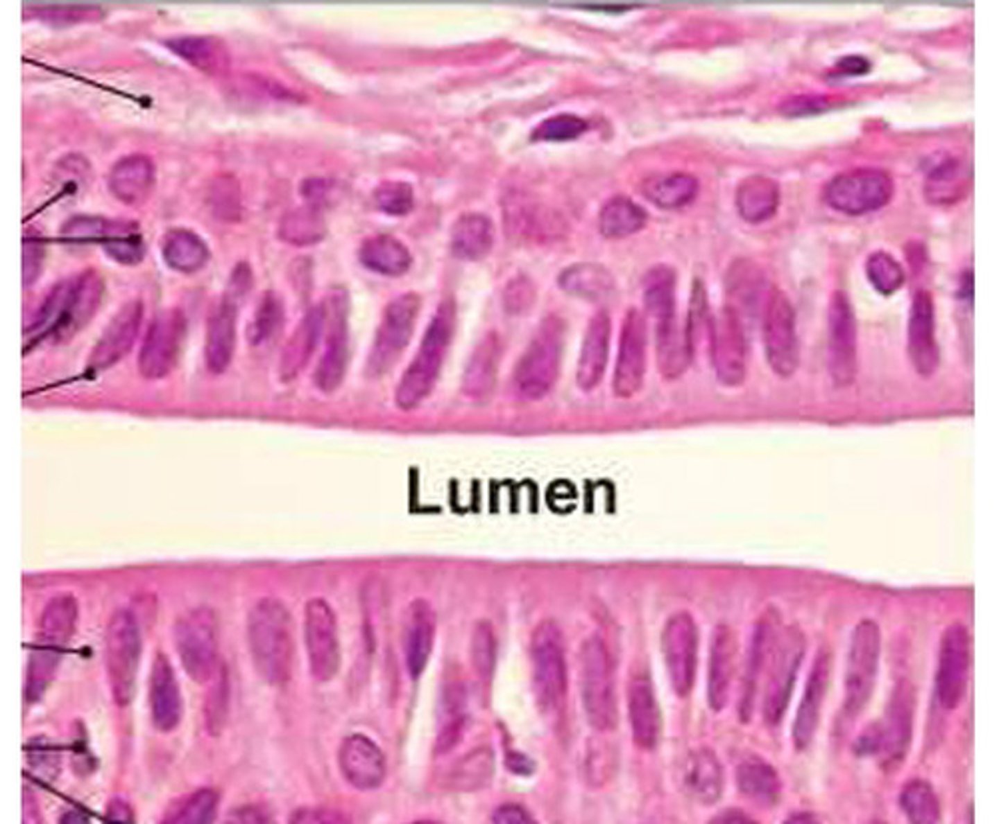 <p>- function: protection</p><p>- locations: small areas of the pharynx, salivary gland ducts</p>