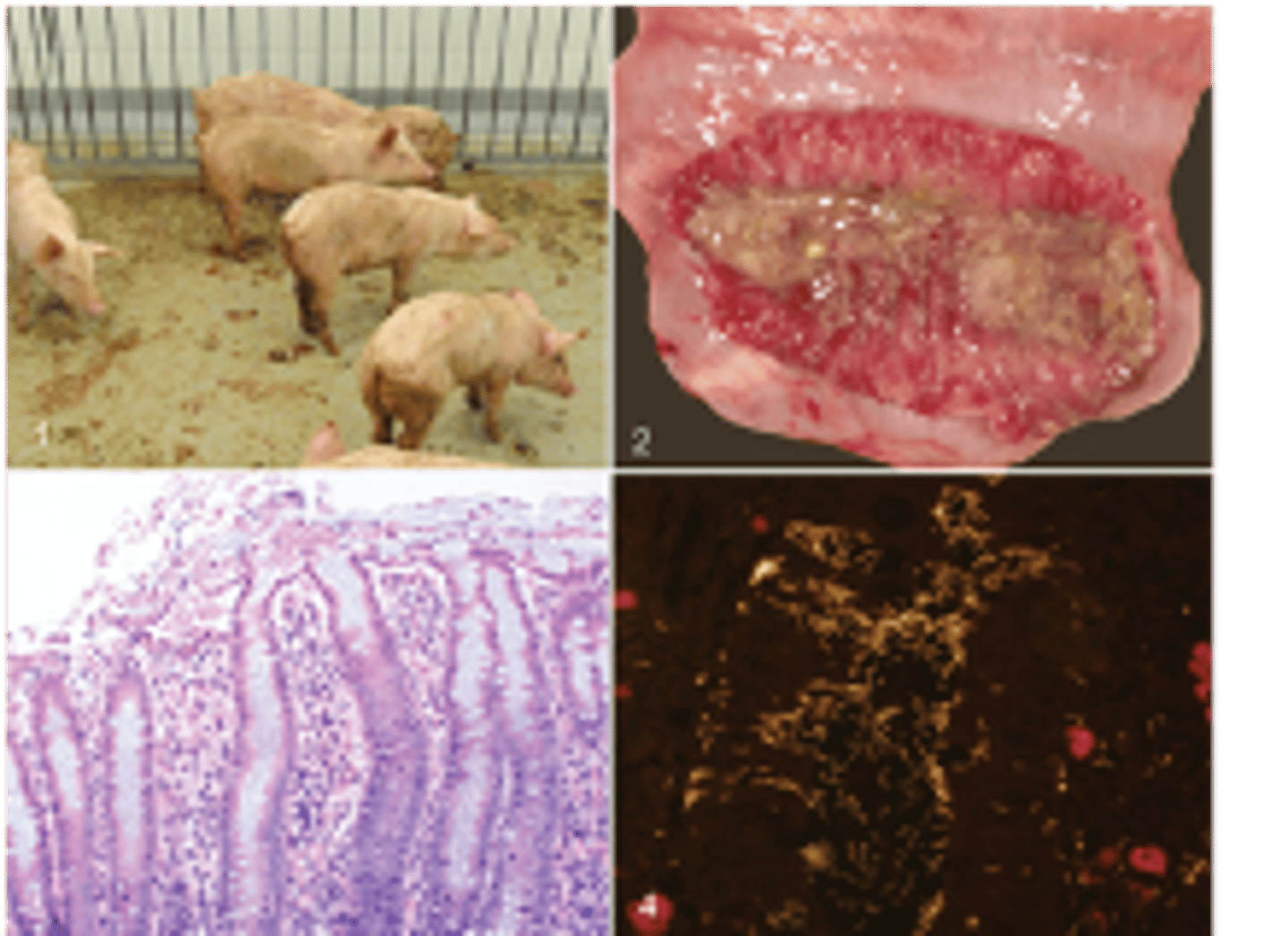 <p>the disease state in these images points to what disease</p>