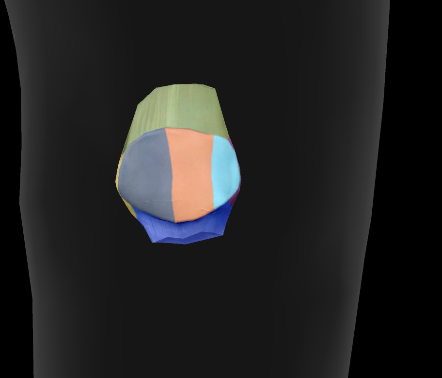 <p>The surface of the femur that articulates with the medial meniscus and the tibia. </p>