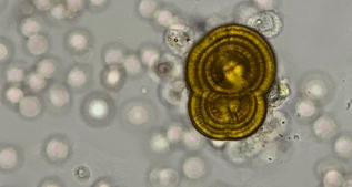<p>What do you see in this image?</p><p>Is it clinically significant?</p><p>Acidic or Alkaline?</p><p>What can it indicate?</p>