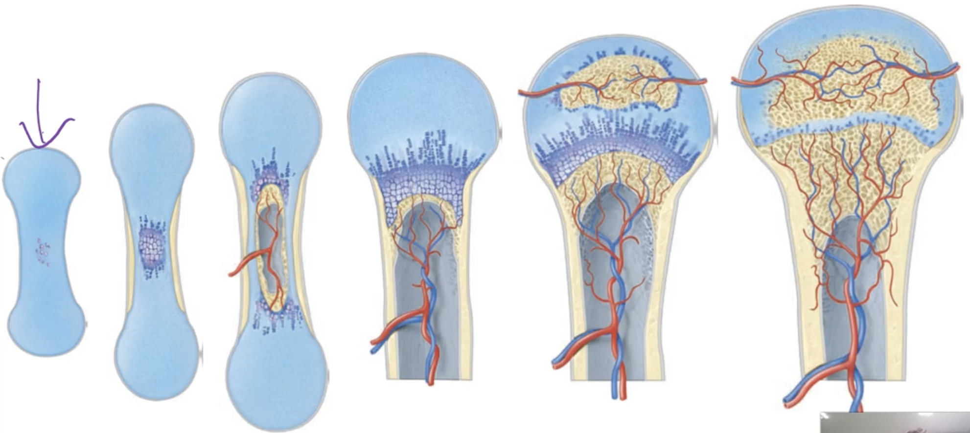<p>-Hyaline cartilage: Makes up the initial model/ starting process of endochondral ossification, where it slowly starts turning into a proper bone</p><p></p><p>-Middle of cartilage changes into bone first </p><p></p><p>-In the end only a bit of cartilage is left</p>