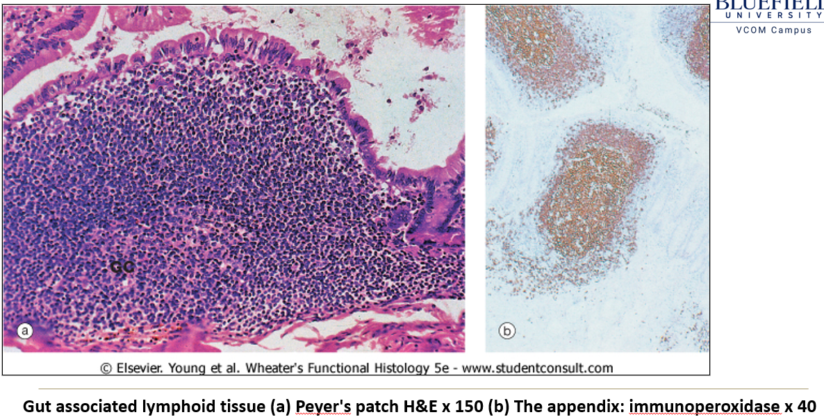 <ul><li><p><strong>Ileum</strong>: <strong>Peyer’s patches</strong>.</p></li><li><p><strong>Appendix</strong>: Lymphoid aggregates.</p></li></ul><p></p>