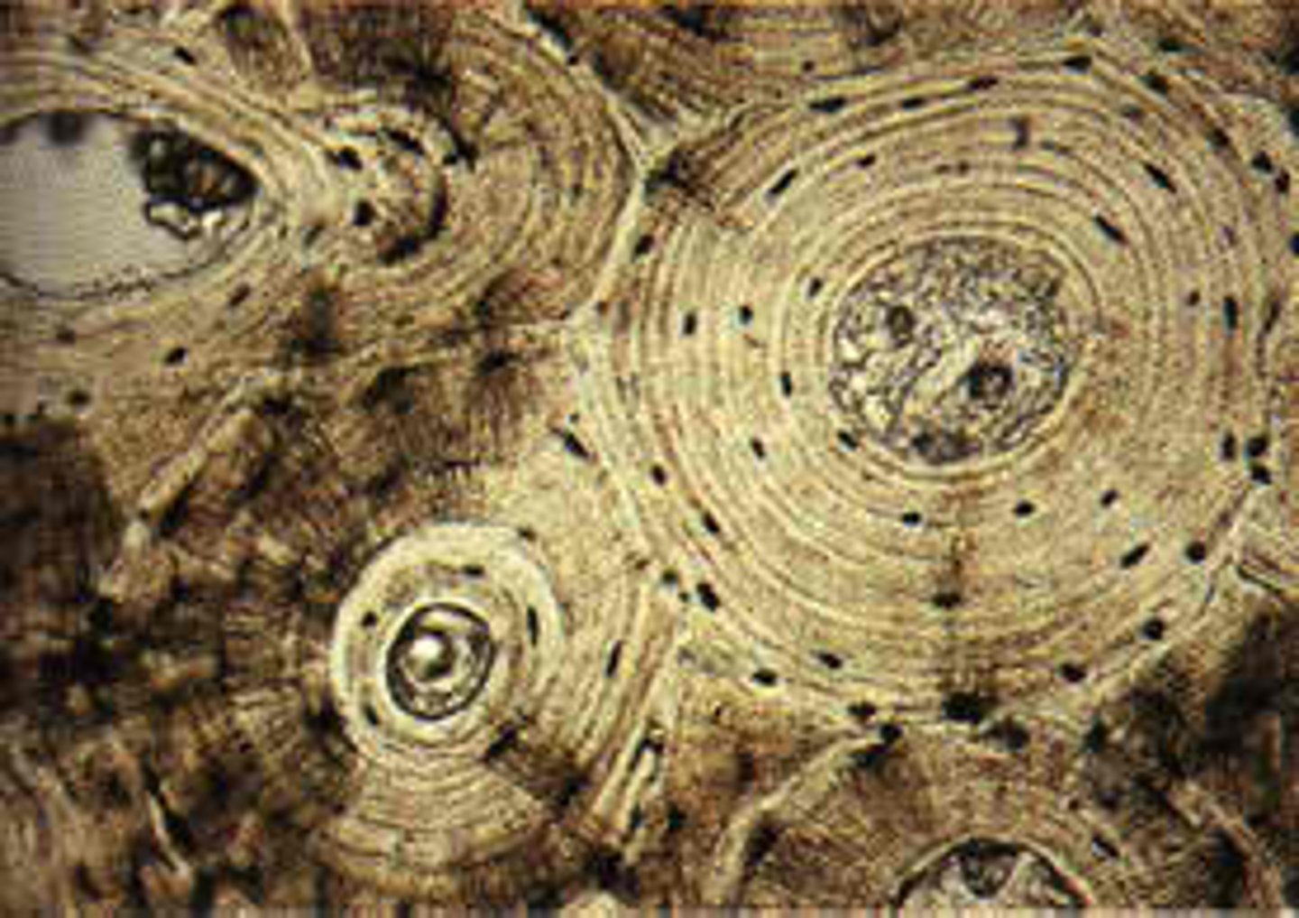 <p>hard, dense bone tissue that is found in the diaphysis of a long bone</p>