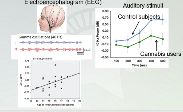 <p>Electroencephalogram (EEG)</p>