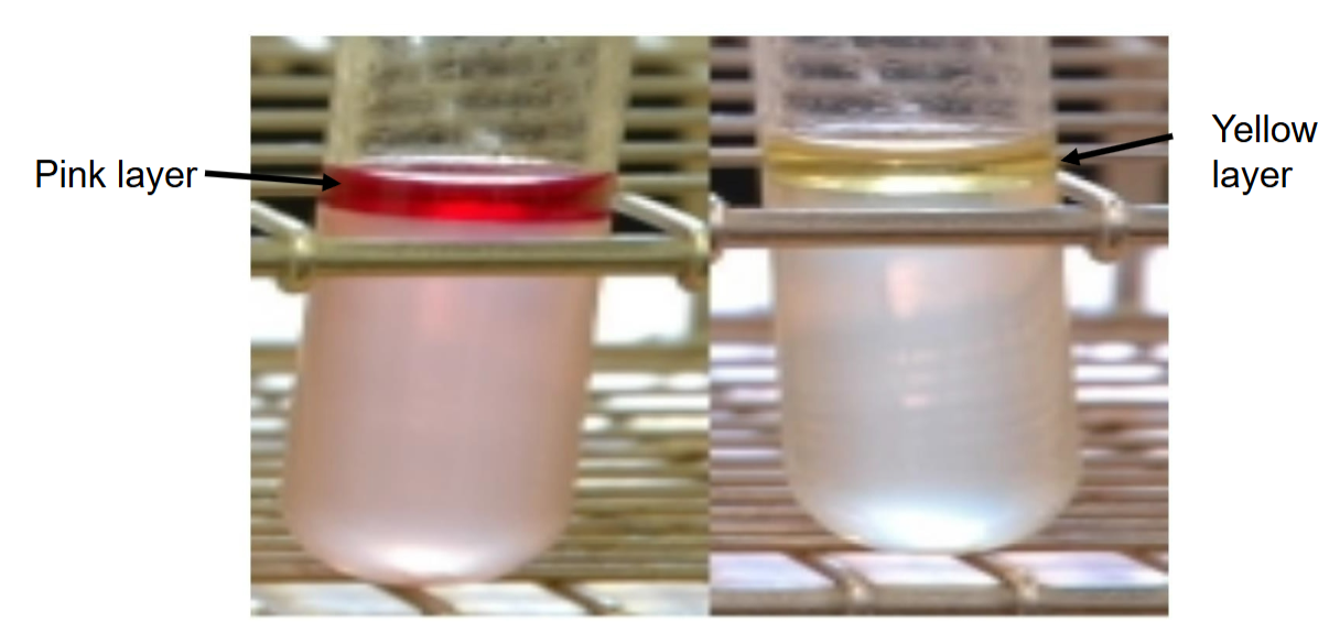 <p><strong>Indole Test</strong> —</p><ul><li><p>What reagent is added to detect indole?</p></li><li><p>Which test tube is a positive reaction?</p></li><li><p>Is this test part of <strong>IMVIC</strong>?</p></li></ul><p><br></p>