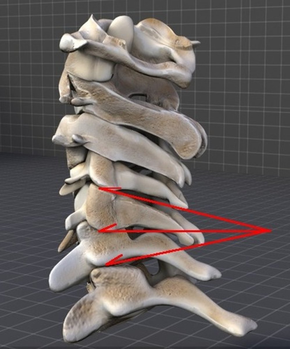 <p>formed by adjoining vertebral bodies</p>
