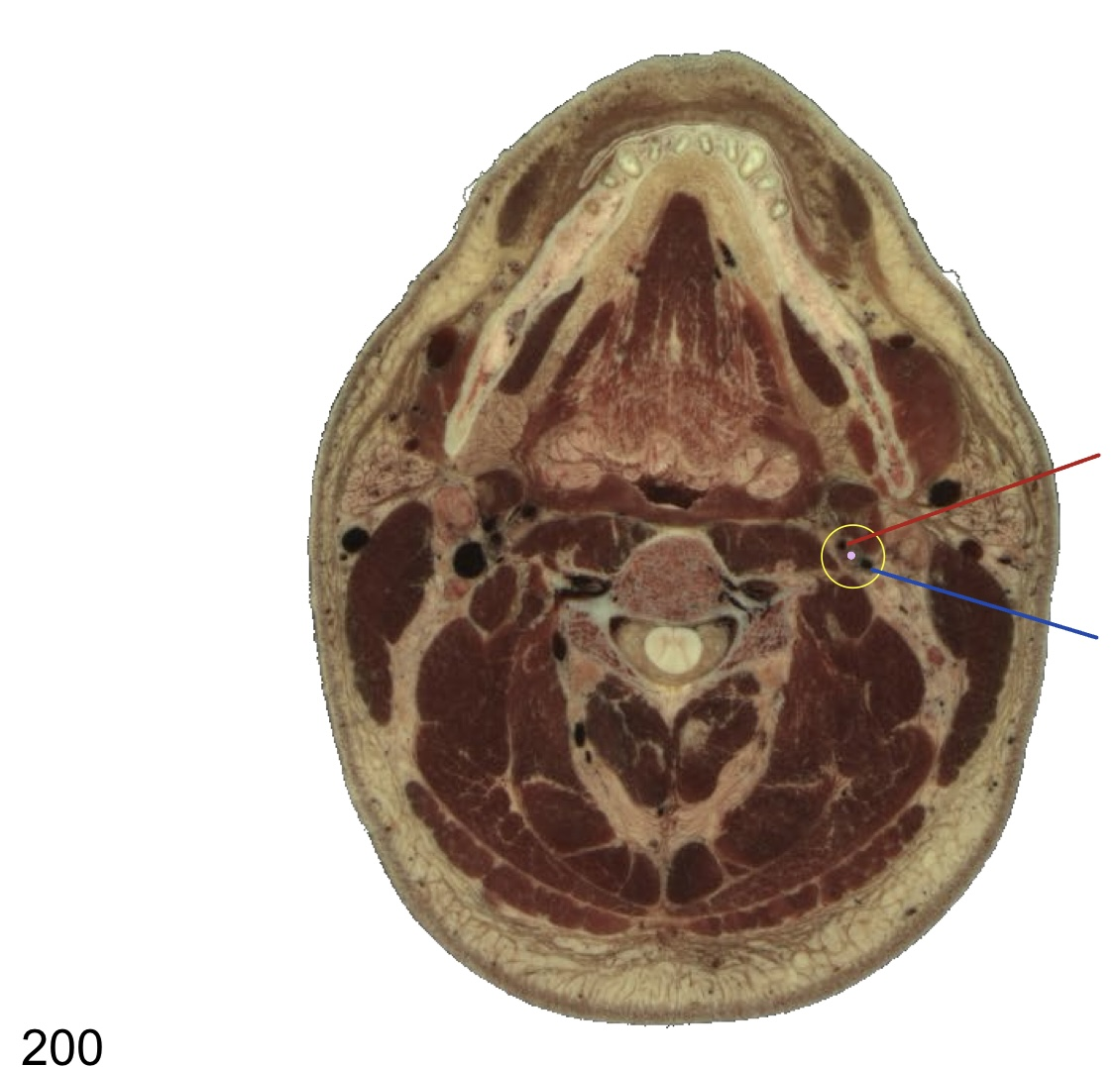<p>what structure is indicated with the lilac dot?</p>