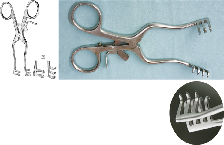 <ul><li><p>maintains muscle retraction during orthopedic surgery</p></li><li><p>prongs come in 3x4 configuration</p></li><li><p>4, 5 1/2, 6 1/2, 8, and 9 1/2 inches long</p></li><li><p>4 inches is called baby weitlaner</p></li></ul>