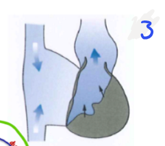 <p>Blut wird ausgestossen<br>Vorhof wird Grösser / Kammer wird halb so gross => Ansaugung des Blutes durch die Venen ins Herz<br>Durch<strong> kleineren Druck</strong> in der Kammer schliessen sich die <strong>Taschenklappen automatisch</strong>, da Druck in Lungenarterie grösser ist</p>