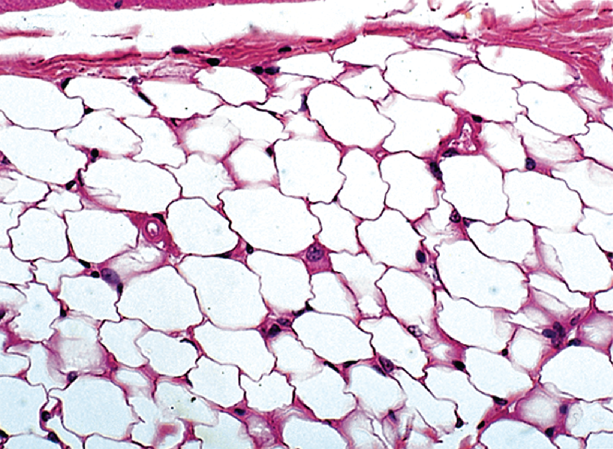 <p><span style="color: blue"><strong>Adipose</strong></span> Connective Tissue</p>