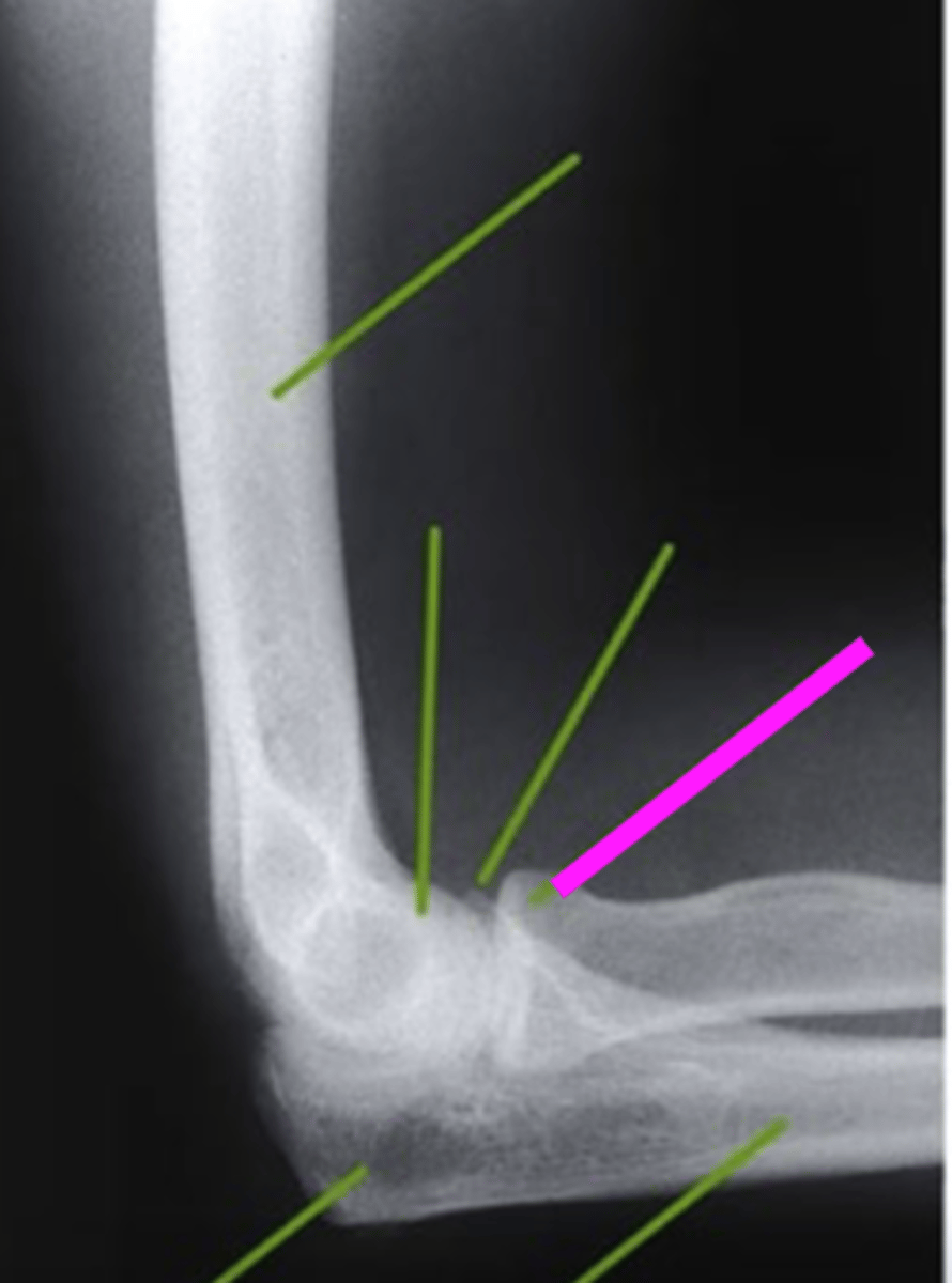 <p>what does the pink line point to?</p>