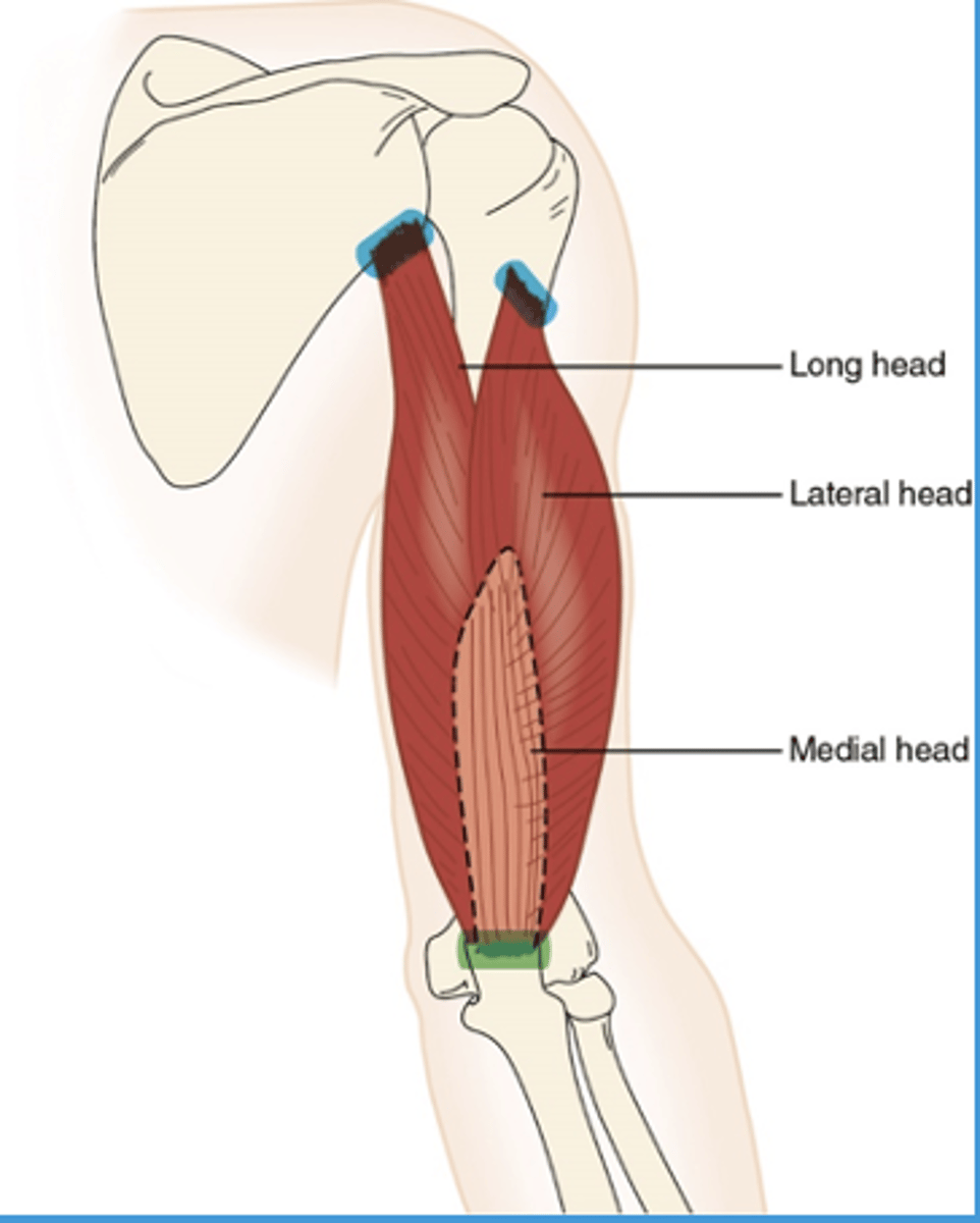 <p>What muscle is this?</p>