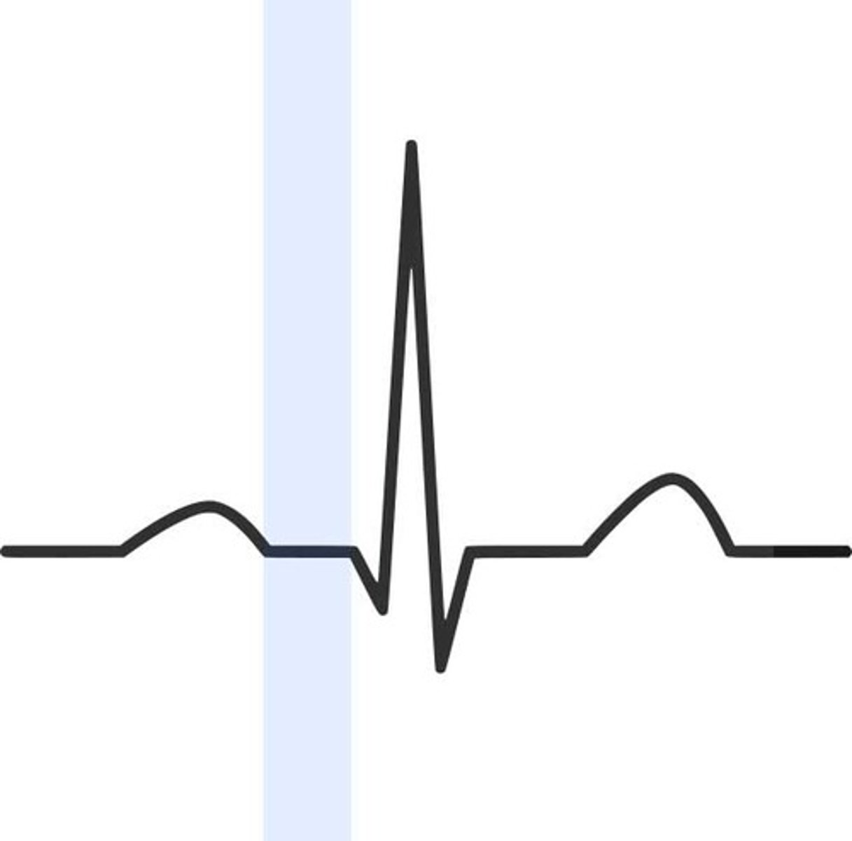 <p>conduction through AV node and AV bundle</p>