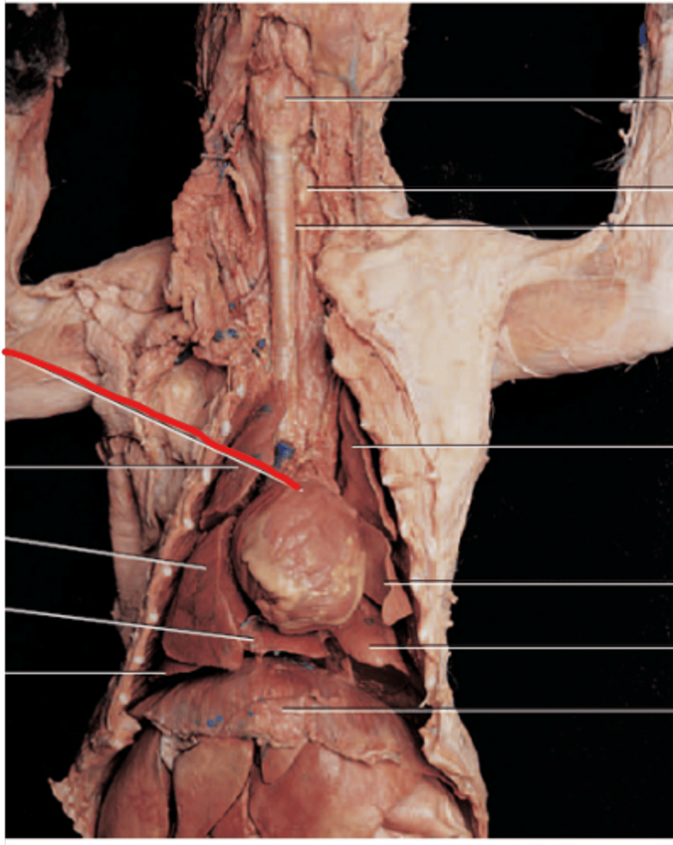 <p>A hollow, muscular organ that pumps blood throughout the body.</p>