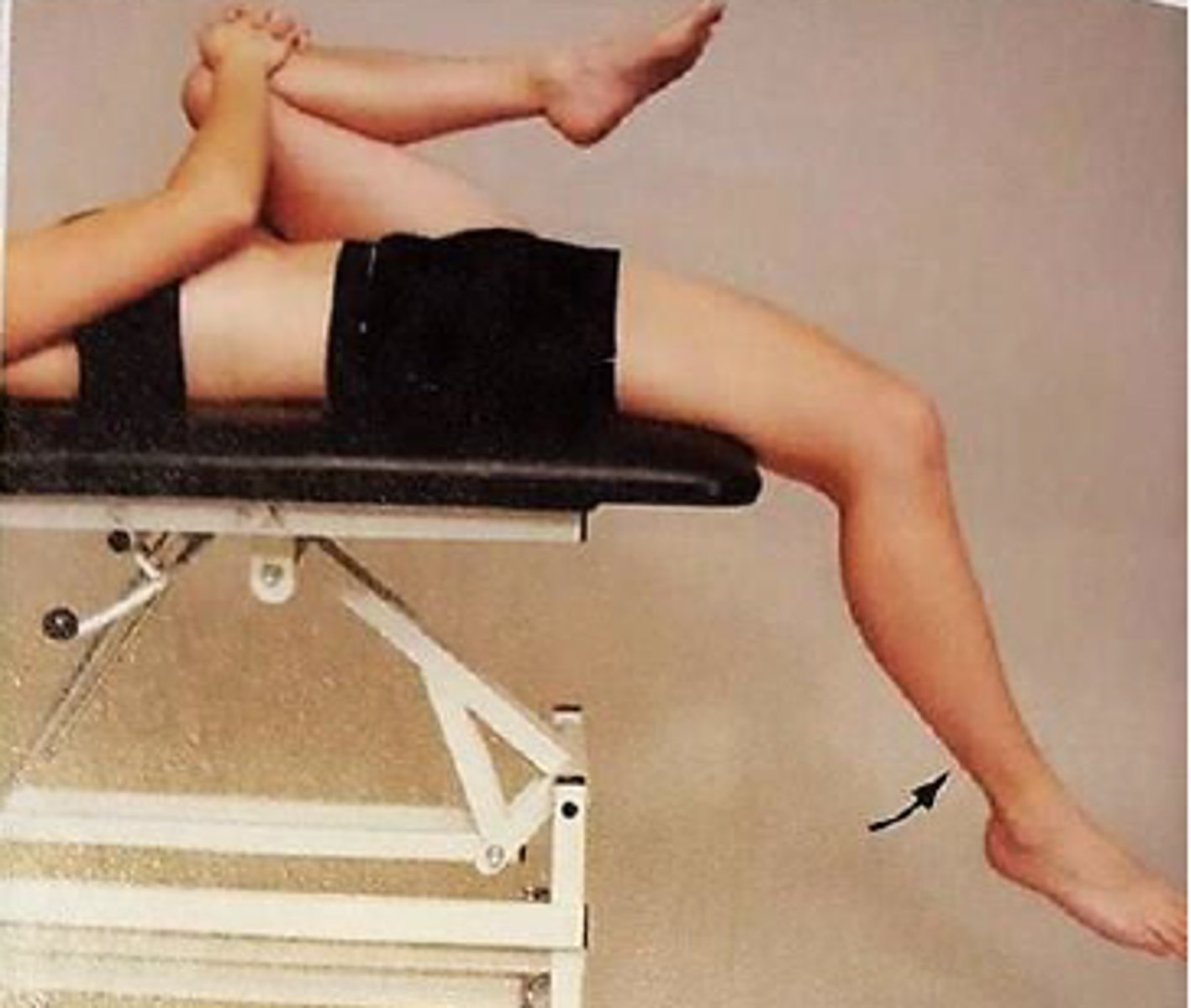 <p>C. the rectus femoris</p>