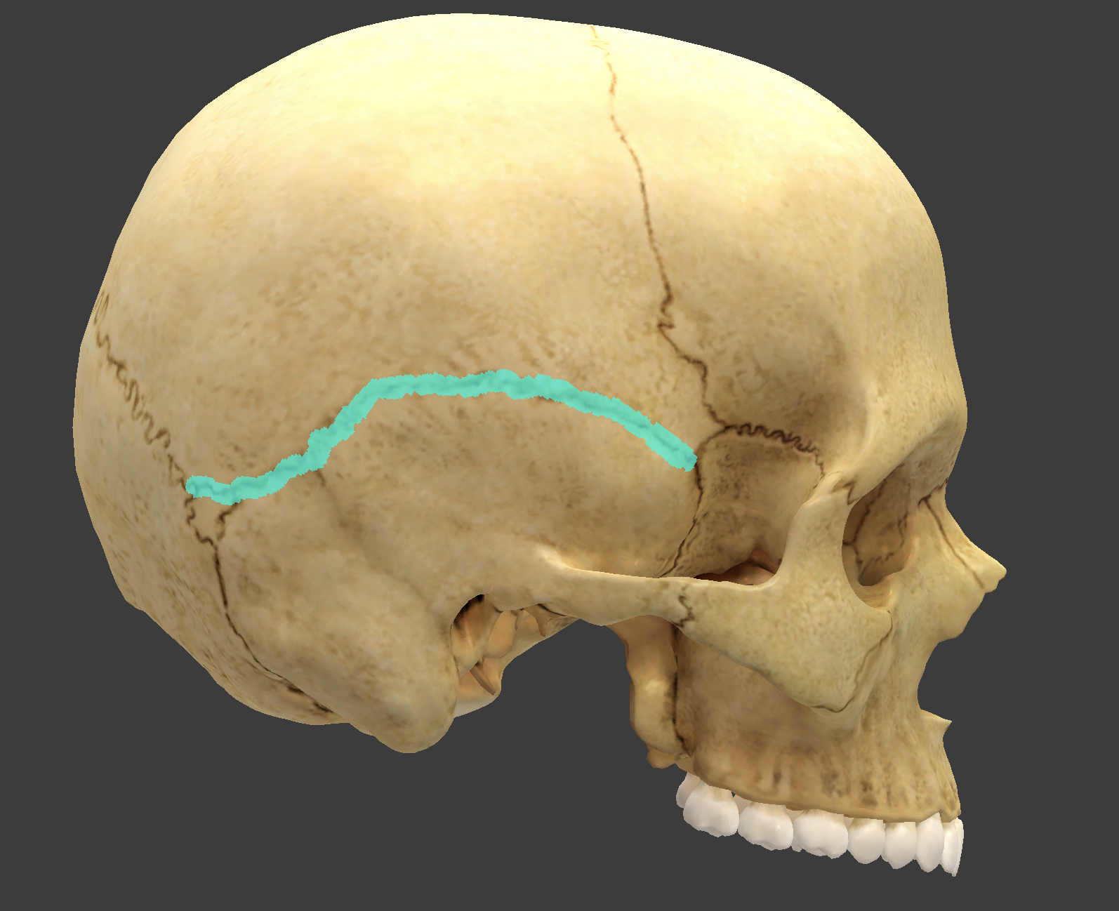 <p>what is this suture?</p>