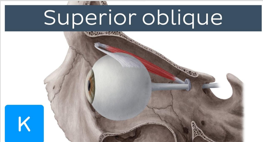 <p>Lesser wing of the sphenoid bone</p><p>Medial to optic canal (Near frontoethmoid suture)</p>