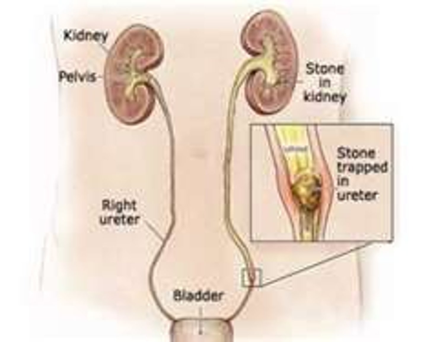 <p>A small, hollow tube that carries urine from the kidneys to the bladder.</p>