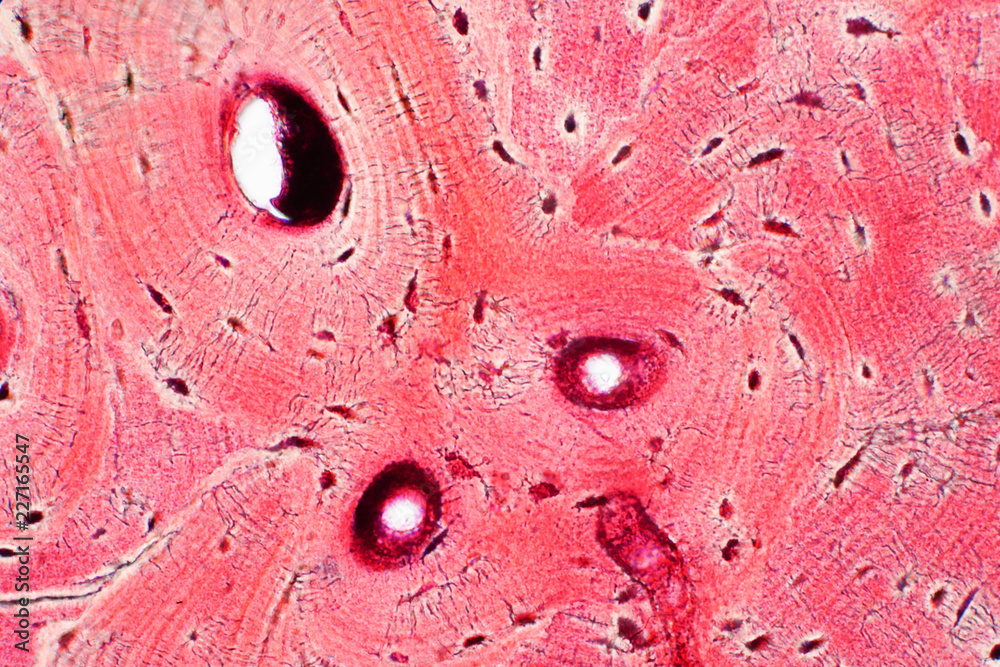 <p>Bone Tissue:</p>