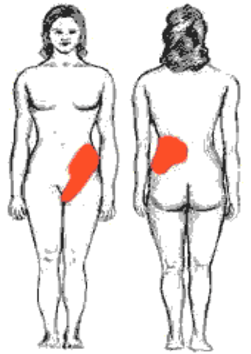 <p>referred pain of what area</p>