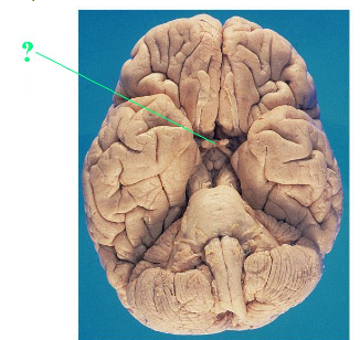 <p><span>Identify the indicated structure of the brain.</span></p>