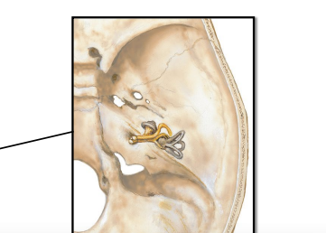 <p>Temporal bone</p>