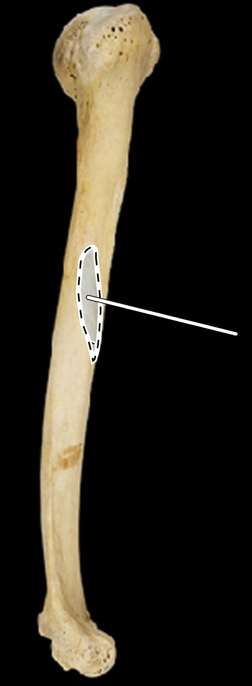 <p>Name the highlighted portion.</p><p>(Lateral view, right side).</p>