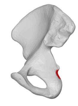 <p>inferior to ischial spine</p>
