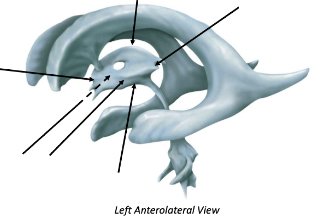 <p>Third Ventricle</p>