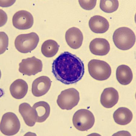 <p>What is this leukocyte?</p>