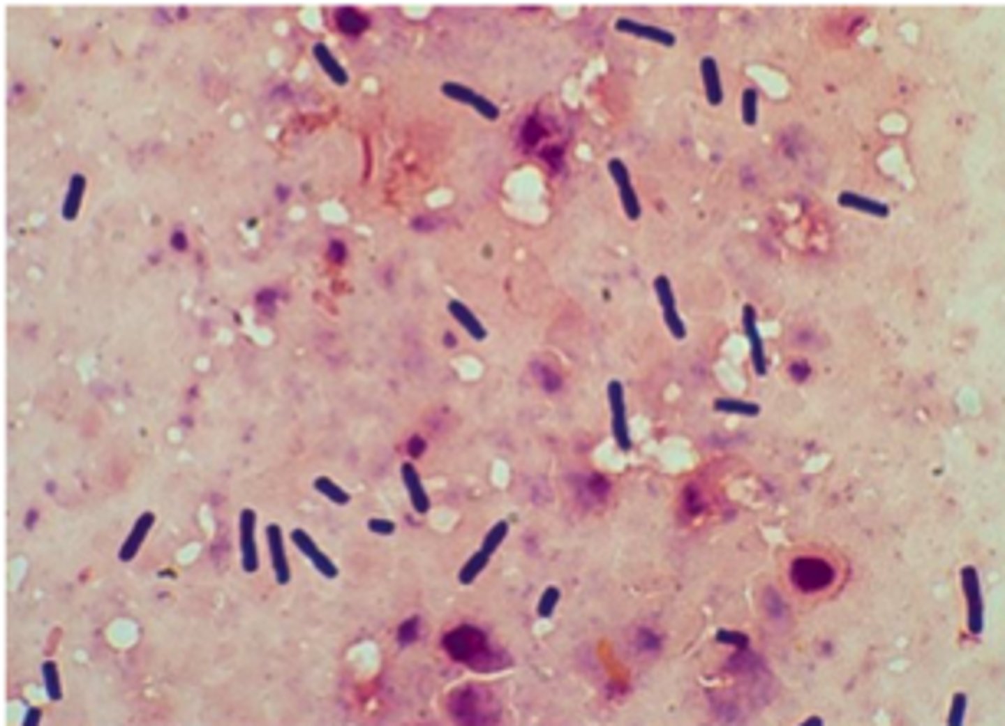 <p>Clostridium_____________gram stain large rectangular gram positive bacilli</p>
