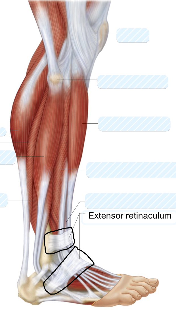 <p>extensor retinaculum </p>