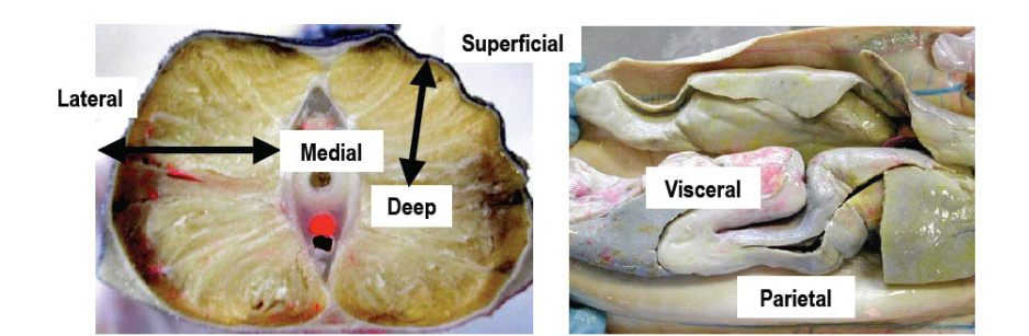 <p>toward or on the surface of the body or surface of a structure</p>