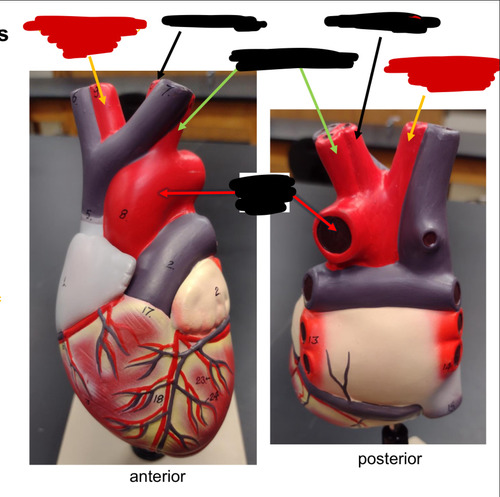 <p>Name this heart vessel</p>