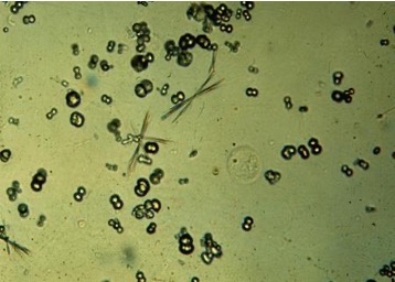 <p>Calcium carbonate</p>