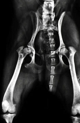 <p>Why would you suspect aseptic necrosis of the femoral head on this radiograph?</p><p>Note: This radiograph is a unilateral case of aseptic necrosis of the femoral head</p>