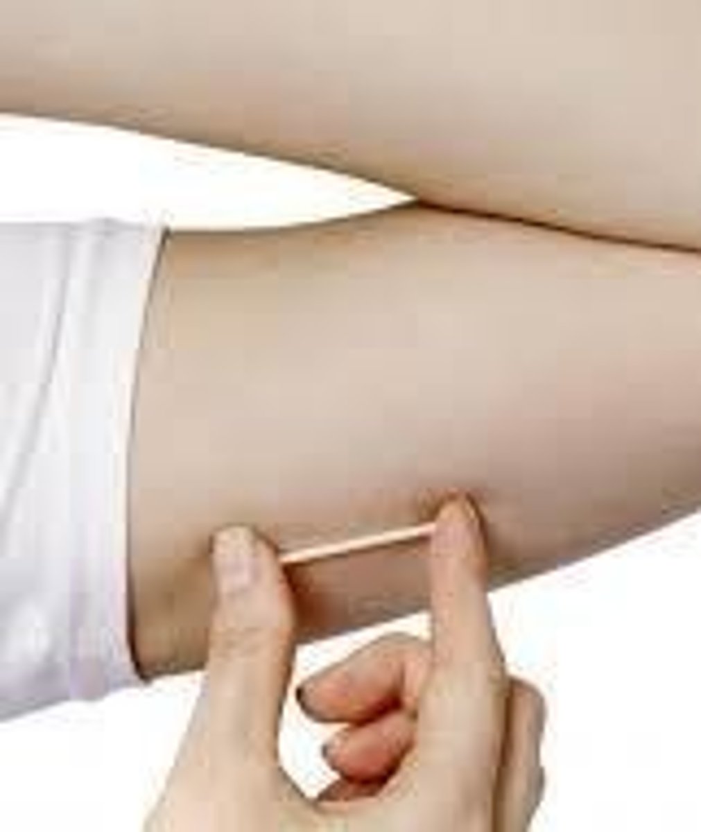 <p>Implantable device releasing hormones for 3 years.</p>