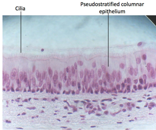 <p>pseudostratified ciliated columnar epithelium </p>