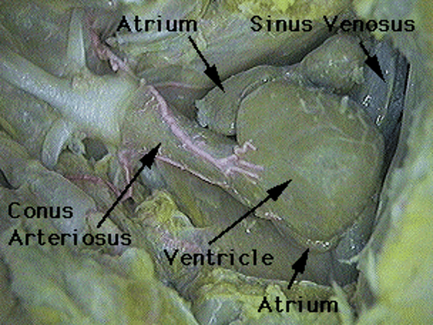 <p>Receives systemic venous blood and channels to right atrium — Triangular chamber on dorsal surface of heart</p>