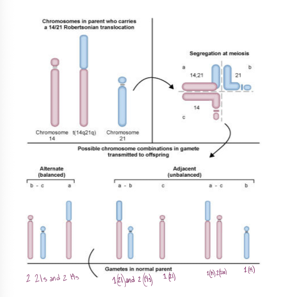 <p>-involves acrocentric chromosomes 13, 14, 15, 21, and 22</p><p>-pair during meiosis and different chromosome combinations occur in genes </p><p>-gametes fertilized from a normal parent will lead to down syndrome in 15% of maternal translocation carriers and 2% of paternal translocation carriers </p><p>-Can have a balanced translocation </p>